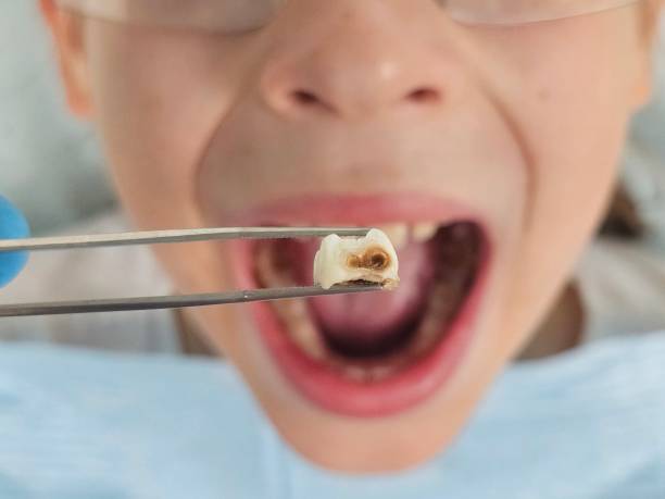 Best Tooth Infection Emergency Dentist  in Beulah, ND